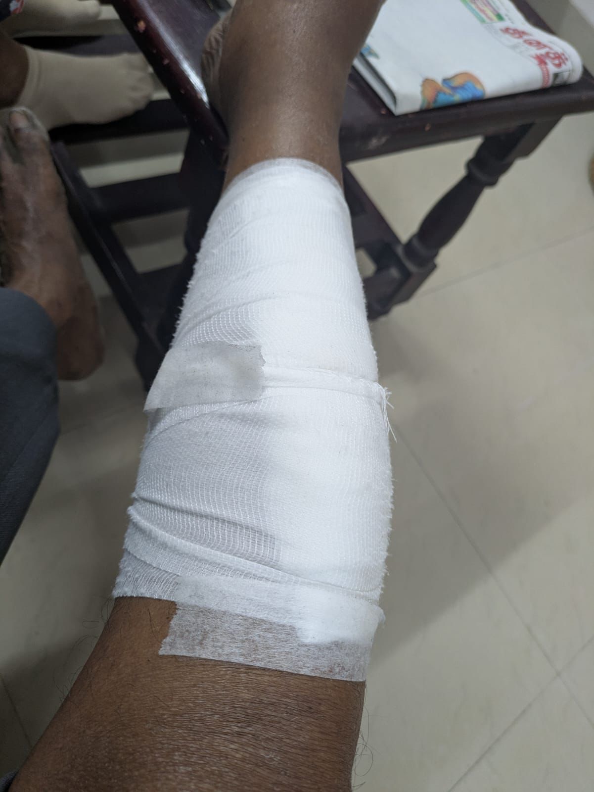 &ldquo;This is a scratch&rdquo; - My dad, 2026